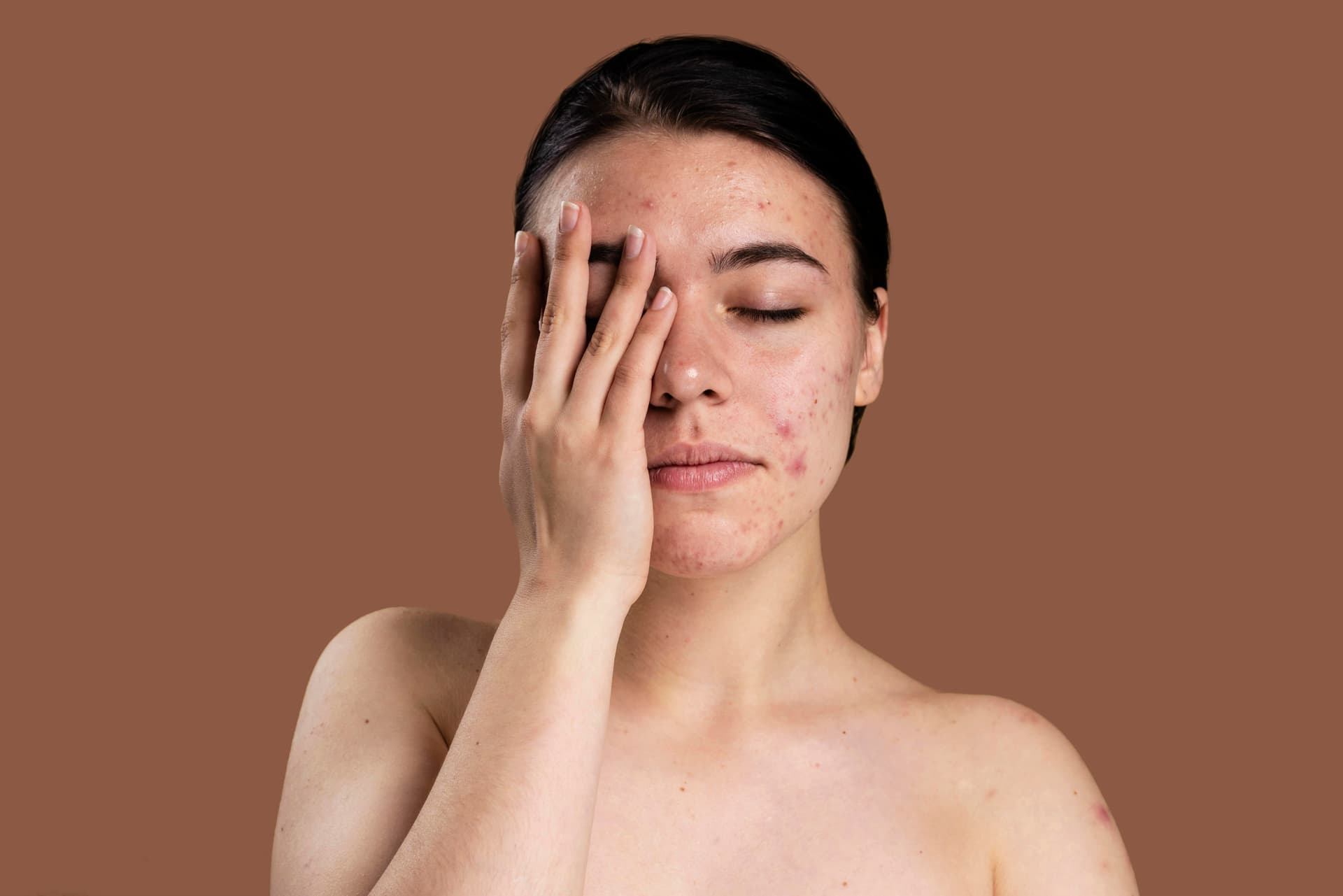 The Pigment Chronicles: Exploring the Levels of Pigmentation and Hyperpigmentationâ€